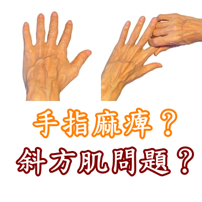 手指麻痺？ 斜角肌問題？