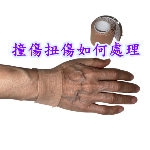 撞傷扭傷如何處理